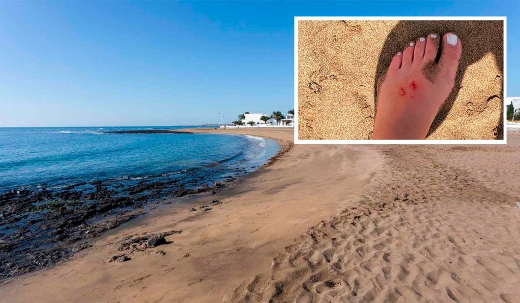 Lanzarote, San Bartolomé: Jugendliche wurde von Engelshai gebissen 92 Jugendliche
