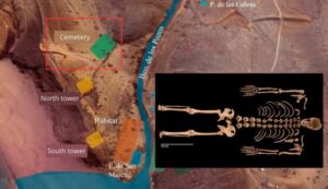 Lanzarote, Yaiza: 600 Jahre altes Skelett mit Paget-Krankheit 24 Knochenfund Lanzarote